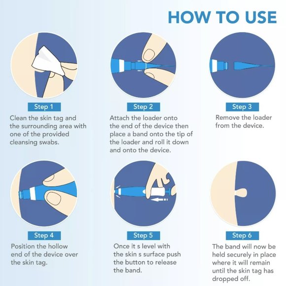 Auto Micro Skin Tag Remover Device Kit - Picture 8 of 8